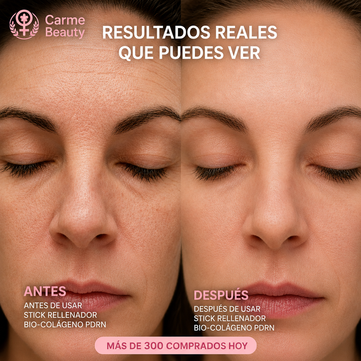 Carmé Beauty™ Stick Rellenador Bio-Colágeno PDRN