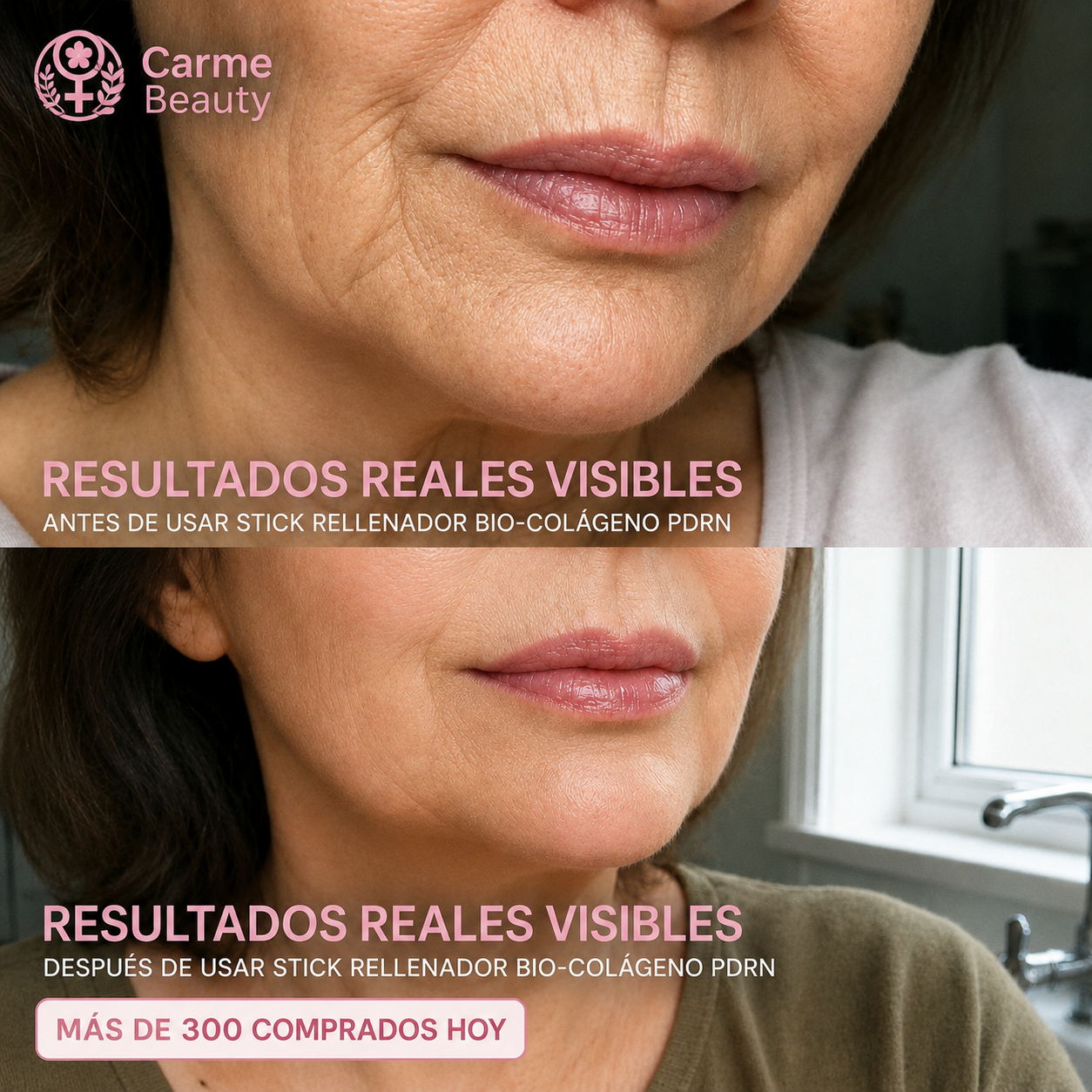 Carmé Beauty™ Stick Rellenador Bio-Colágeno PDRN